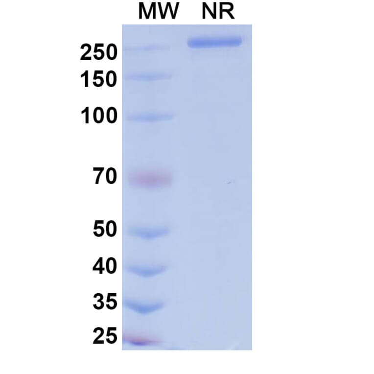 SDS-PAGE - Dalnicastobart Biosimilar - Anti-CD40 Antibody - BSA and Azide free (A339773) - Antibodies.com