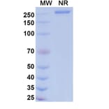 SDS-PAGE - Dalnicastobart Biosimilar - Anti-CD40 Antibody - BSA and Azide free (A339773) - Antibodies.com