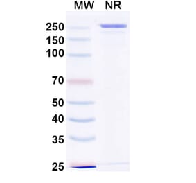 SDS-PAGE - Devextinetug Biosimilar - Anti-ST2 Antibody - BSA and Azide free (A339777) - Antibodies.com