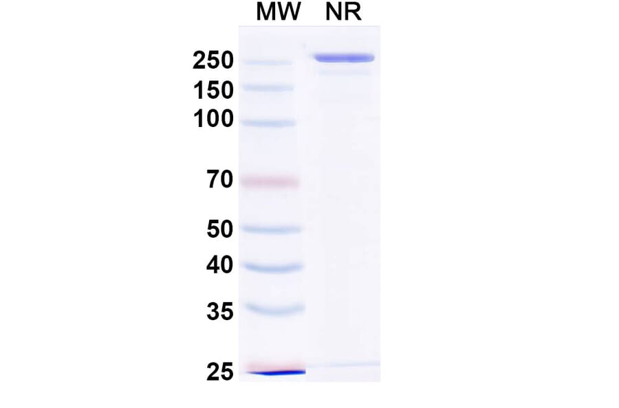 SDS-PAGE - Devextinetug Biosimilar - Anti-ST2 Antibody - BSA and Azide free (A339777) - Antibodies.com