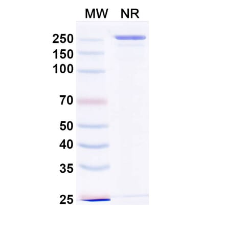 SDS-PAGE - Devextinetug Biosimilar - Anti-ST2 Antibody - BSA and Azide free (A339777) - Antibodies.com