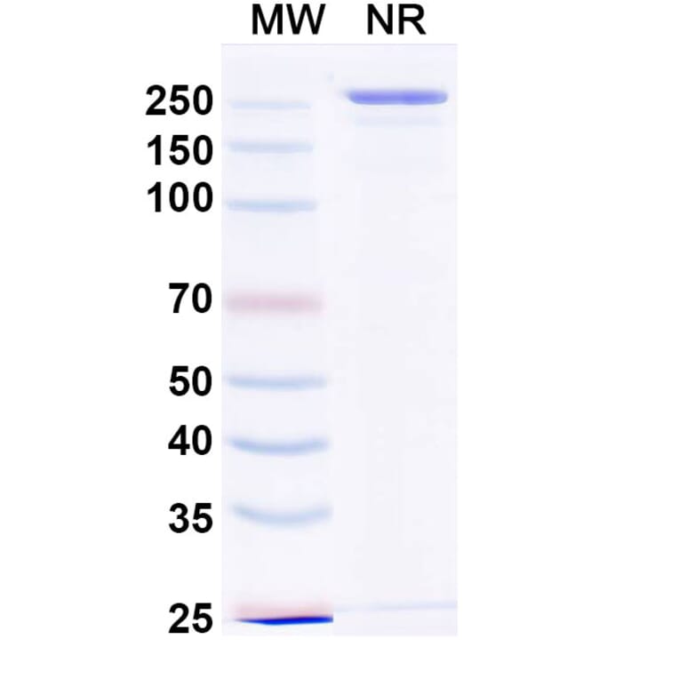 SDS-PAGE - Devextinetug Biosimilar - Anti-ST2 Antibody - BSA and Azide free (A339777) - Antibodies.com