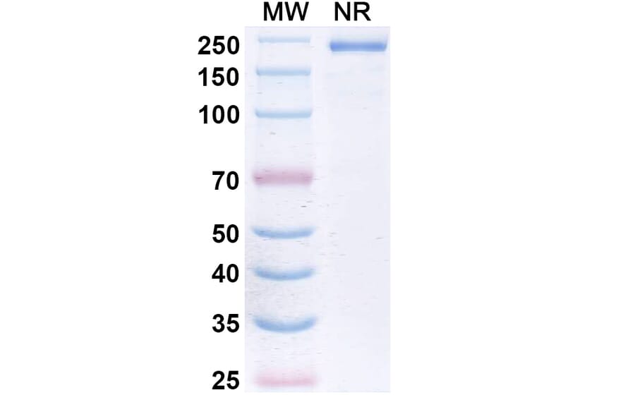 SDS-PAGE - Devextinetug Biosimilar - Anti-ST2 Antibody - BSA and Azide free (A339777) - Antibodies.com