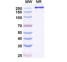 SDS-PAGE - Eglatoprutug Biosimilar - Anti-c-Kit Antibody - BSA and Azide free (A339778) - Antibodies.com