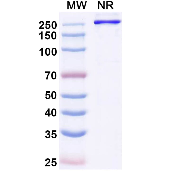 SDS-PAGE - Eglatoprutug Biosimilar - Anti-c-Kit Antibody - BSA and Azide free (A339778) - Antibodies.com