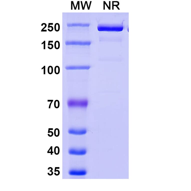 SDS-PAGE - Eglatoprutug Biosimilar - Anti-c-Kit Antibody - BSA and Azide free (A339778) - Antibodies.com