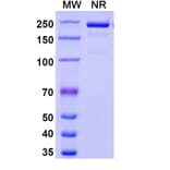 SDS-PAGE - Eglatoprutug Biosimilar - Anti-c-Kit Antibody - BSA and Azide free (A339778) - Antibodies.com