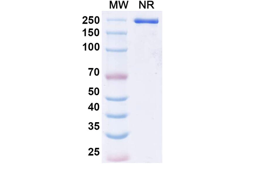 SDS-PAGE - Epacmarstobart Biosimilar - Anti-SIRP alpha Antibody - BSA and Azide free (A339780) - Antibodies.com