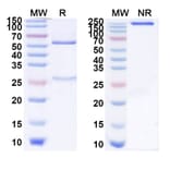 SDS-PAGE - Izeltabart Biosimilar - Anti-ADAM9 Antibody - BSA and Azide free (A339787) - Antibodies.com