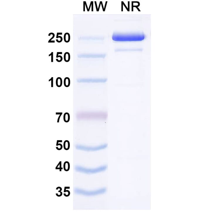 SDS-PAGE - Izeltabart Biosimilar - Anti-ADAM9 Antibody - BSA and Azide free (A339787) - Antibodies.com