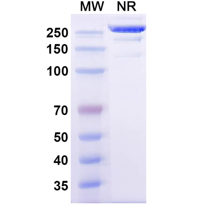SDS-PAGE - Izeltabart Biosimilar - Anti-ADAM9 Antibody - BSA and Azide free (A339787) - Antibodies.com