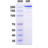SDS-PAGE - Izeltabart Biosimilar - Anti-ADAM9 Antibody - BSA and Azide free (A339787) - Antibodies.com