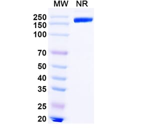 SDS-PAGE - Lipustobart Biosimilar - Anti-PD 1 Antibody - BSA and Azide free (A339789) - Antibodies.com
