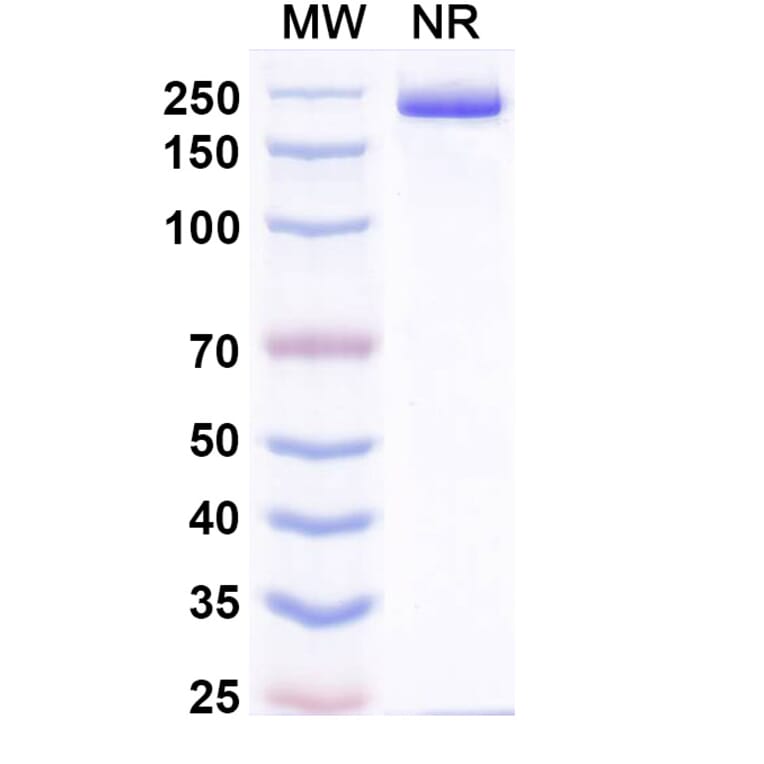 SDS-PAGE - Pradusinstobart Biosimilar - Anti-PD 1 Antibody - BSA and Azide free (A339790) - Antibodies.com