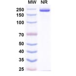 SDS-PAGE - Pradusinstobart Biosimilar - Anti-PD 1 Antibody - BSA and Azide free (A339790) - Antibodies.com