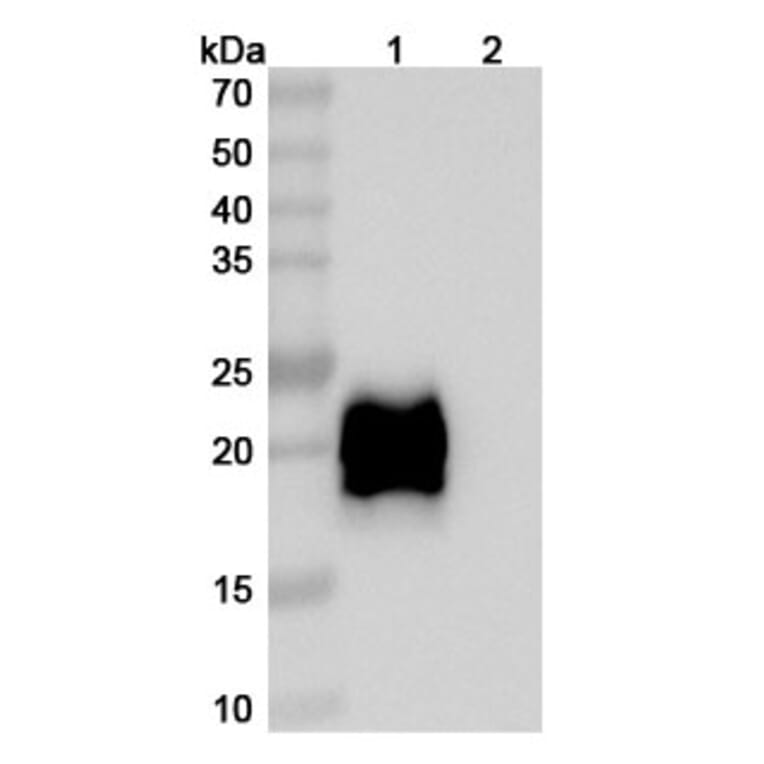 Volrustomig Biosimilar - Anti-PD 1 + CTLA-4 Antibody (A339794)
