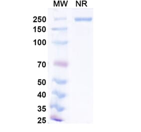 SDS-PAGE - Narlumosbart Biosimilar - Anti-RANKL Antibody - BSA and Azide free (A339796) - Antibodies.com