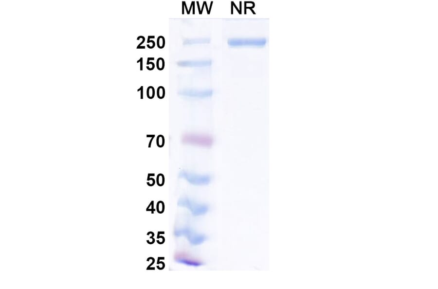 SDS-PAGE - Narlumosbart Biosimilar - Anti-RANKL Antibody - BSA and Azide free (A339796) - Antibodies.com