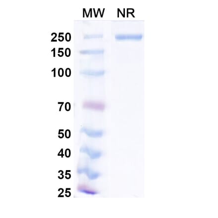 SDS-PAGE - Narlumosbart Biosimilar - Anti-RANKL Antibody - BSA and Azide free (A339796) - Antibodies.com
