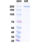 SDS-PAGE - Narlumosbart Biosimilar - Anti-RANKL Antibody - BSA and Azide free (A339796) - Antibodies.com