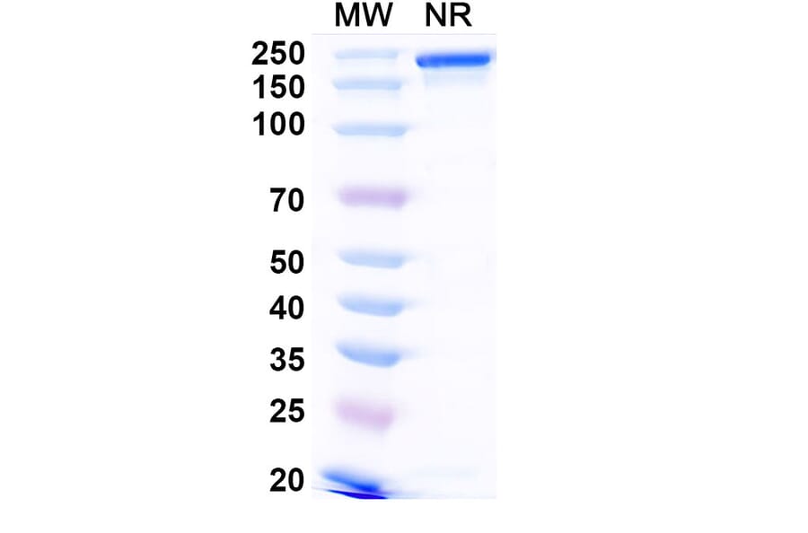 SDS-PAGE - Narlumosbart Biosimilar - Anti-RANKL Antibody - BSA and Azide free (A339796) - Antibodies.com