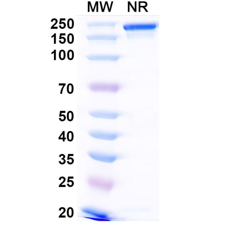 SDS-PAGE - Narlumosbart Biosimilar - Anti-RANKL Antibody - BSA and Azide free (A339796) - Antibodies.com
