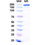 SDS-PAGE - Narlumosbart Biosimilar - Anti-RANKL Antibody - BSA and Azide free (A339796) - Antibodies.com