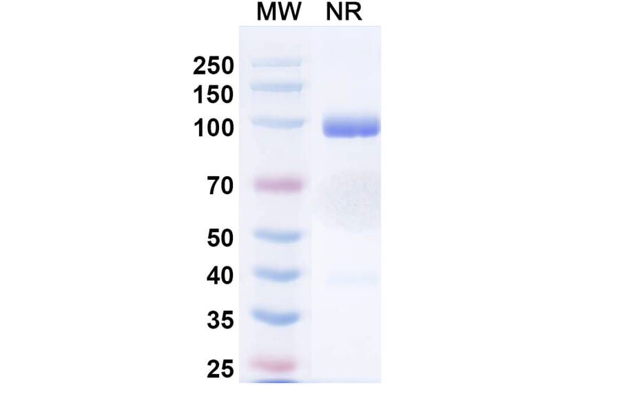 SDS-PAGE - Porustobart Biosimilar - Anti-CTLA-4 Antibody - BSA and Azide free (A339800) - Antibodies.com