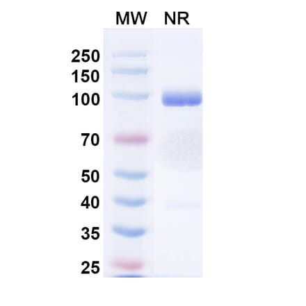 SDS-PAGE - Porustobart Biosimilar - Anti-CTLA-4 Antibody - BSA and Azide free (A339800) - Antibodies.com
