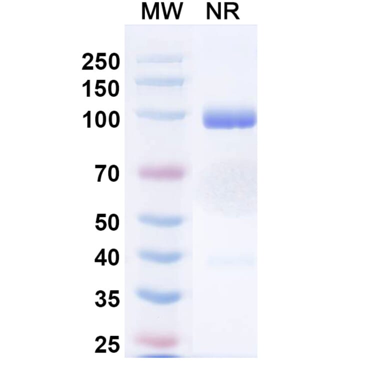 SDS-PAGE - Porustobart Biosimilar - Anti-CTLA-4 Antibody - BSA and Azide free (A339800) - Antibodies.com