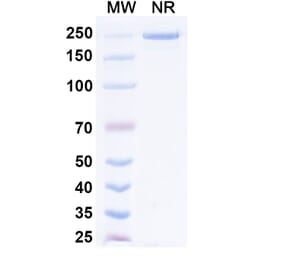 SDS-PAGE - Prafnosbart Biosimilar - Anti-ACVR1 Antibody - BSA and Azide free (A339801) - Antibodies.com