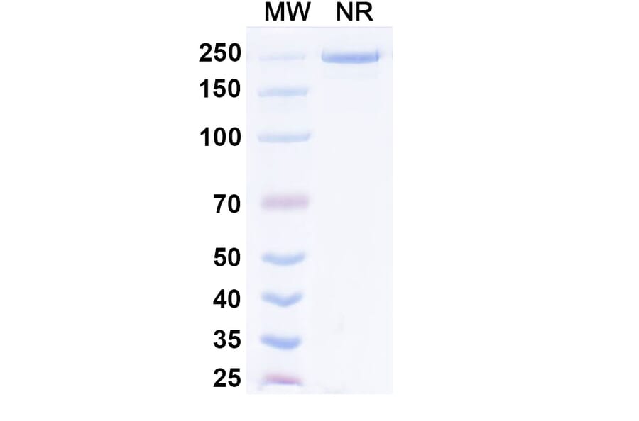 SDS-PAGE - Prafnosbart Biosimilar - Anti-ACVR1 Antibody - BSA and Azide free (A339801) - Antibodies.com
