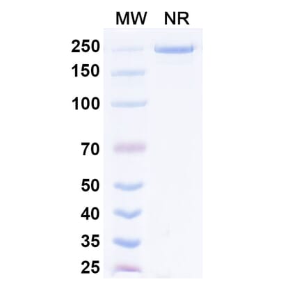 SDS-PAGE - Prafnosbart Biosimilar - Anti-ACVR1 Antibody - BSA and Azide free (A339801) - Antibodies.com