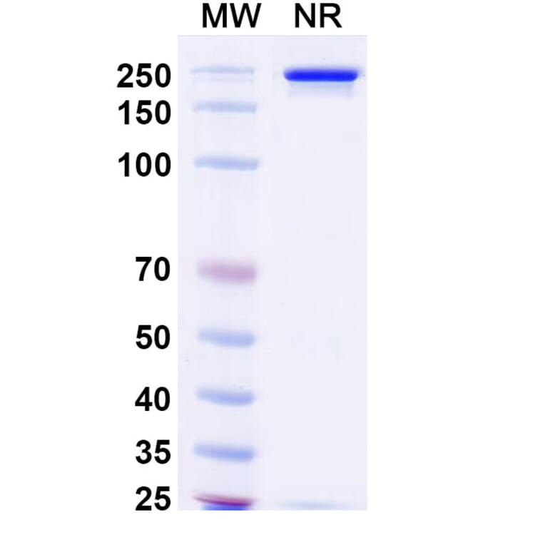 SDS-PAGE - Prafnosbart Biosimilar - Anti-ACVR1 Antibody - BSA and Azide free (A339801) - Antibodies.com