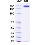 SDS-PAGE - Prafnosbart Biosimilar - Anti-ACVR1 Antibody - BSA and Azide free (A339801) - Antibodies.com