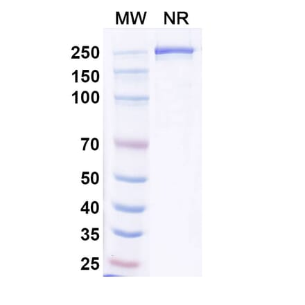 SDS-PAGE - Resugosbart Biosimilar - Anti-Sclerostin Antibody - BSA and Azide free (A339803) - Antibodies.com
