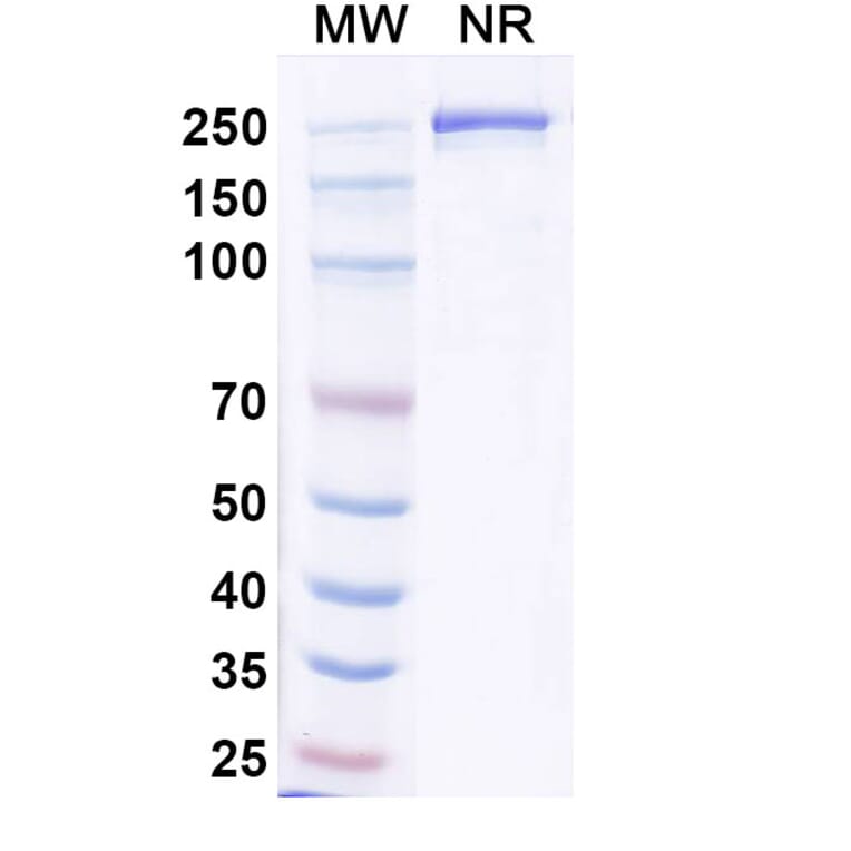SDS-PAGE - Resugosbart Biosimilar - Anti-Sclerostin Antibody - BSA and Azide free (A339803) - Antibodies.com