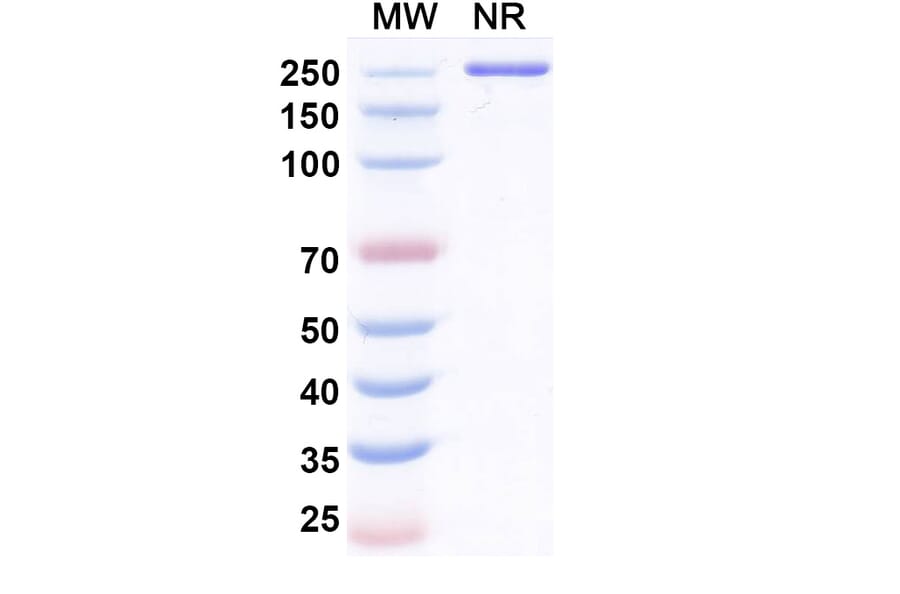 SDS-PAGE - Resugosbart Biosimilar - Anti-Sclerostin Antibody - BSA and Azide free (A339803) - Antibodies.com