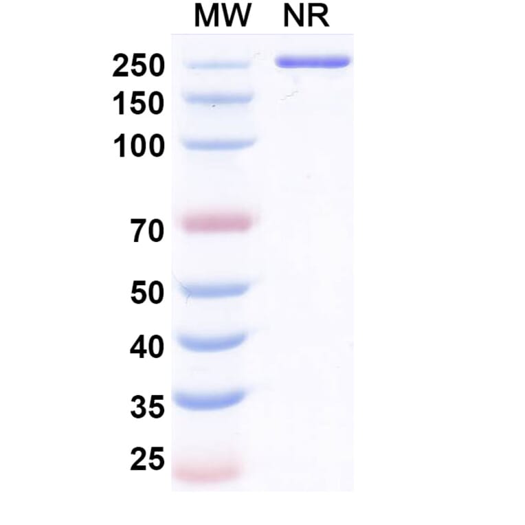 SDS-PAGE - Resugosbart Biosimilar - Anti-Sclerostin Antibody - BSA and Azide free (A339803) - Antibodies.com