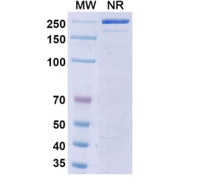 SDS-PAGE - Riltovetbart Biosimilar - Anti-IL31 Antibody - BSA and Azide free (A339804) - Antibodies.com