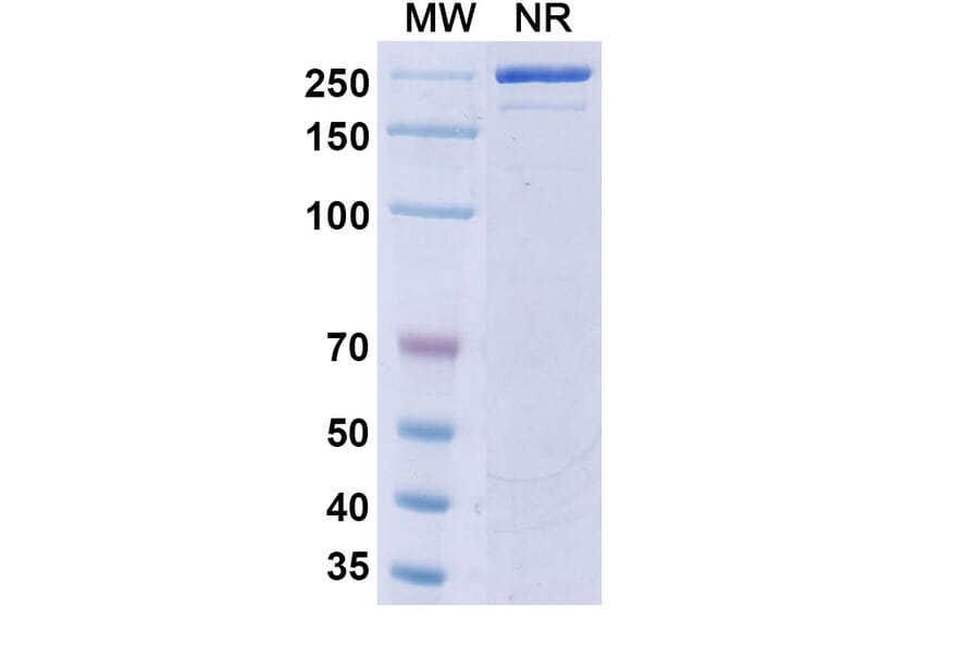 SDS-PAGE - Riltovetbart Biosimilar - Anti-IL31 Antibody - BSA and Azide free (A339804) - Antibodies.com