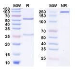 SDS-PAGE - Riltovetbart Biosimilar - Anti-IL31 Antibody - BSA and Azide free (A339804) - Antibodies.com