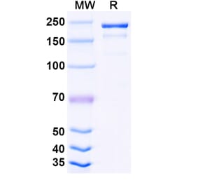 SDS-PAGE - Tuparstobart Biosimilar - Anti-LAG 3 Antibody - BSA and Azide free (A339808) - Antibodies.com