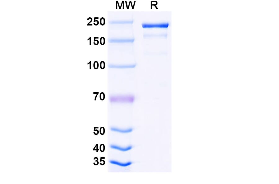 SDS-PAGE - Tuparstobart Biosimilar - Anti-LAG 3 Antibody - BSA and Azide free (A339808) - Antibodies.com