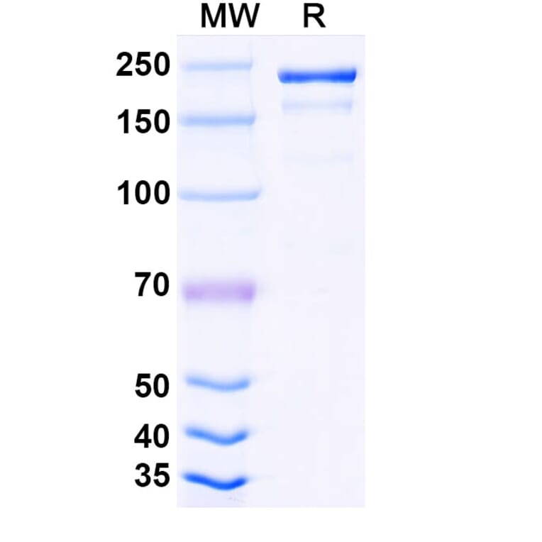 SDS-PAGE - Tuparstobart Biosimilar - Anti-LAG 3 Antibody - BSA and Azide free (A339808) - Antibodies.com