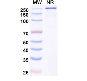 SDS-PAGE - Varokibart Biosimilar - Anti-IL-5 Antibody - BSA and Azide free (A339811) - Antibodies.com