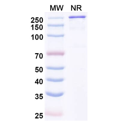 SDS-PAGE - Varokibart Biosimilar - Anti-IL-5 Antibody - BSA and Azide free (A339811) - Antibodies.com