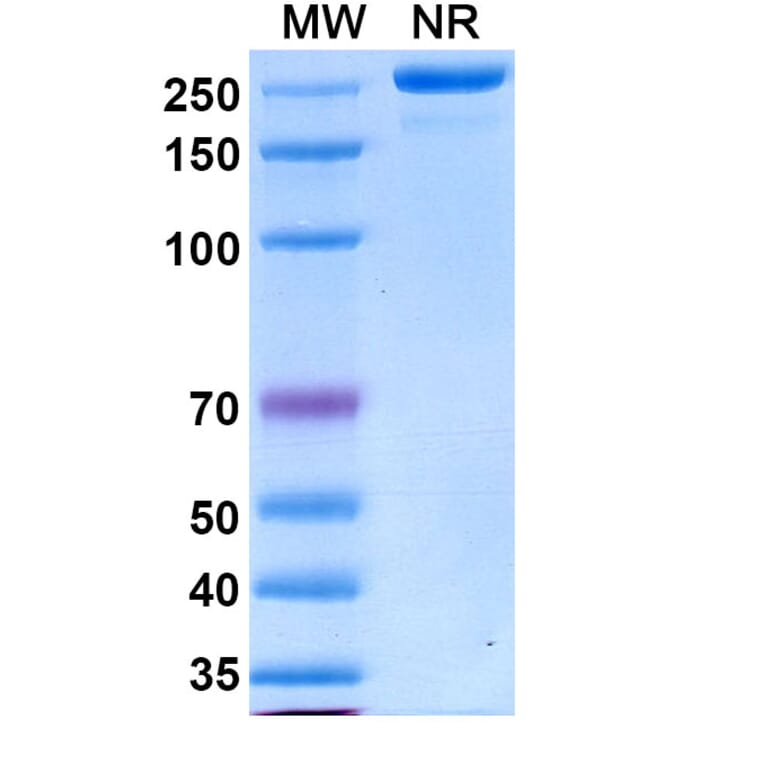 SDS-PAGE - Varokibart Biosimilar - Anti-IL-5 Antibody - BSA and Azide free (A339811) - Antibodies.com