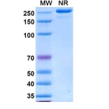 SDS-PAGE - Varokibart Biosimilar - Anti-IL-5 Antibody - BSA and Azide free (A339811) - Antibodies.com