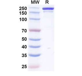 SDS-PAGE - Vilamakitug Biosimilar - Anti-IL-1 alpha Antibody - BSA and Azide free (A339812) - Antibodies.com